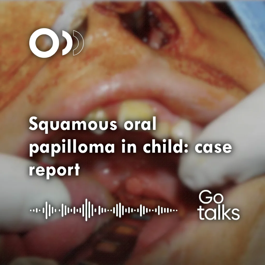 Squamous oral papilloma in child: case report