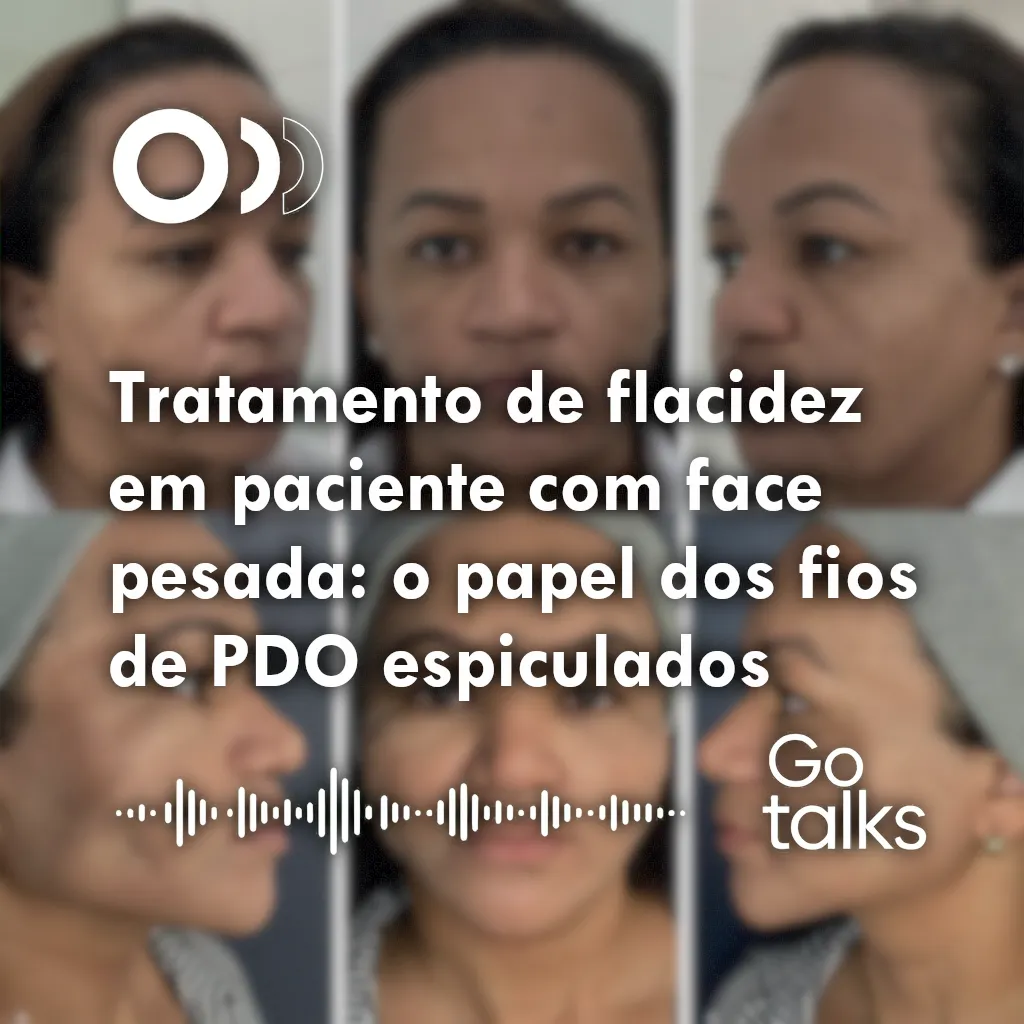 Tratamento de flacidez em paciente com face pesada: o papel dos fios de PDO espiculados