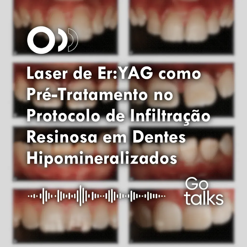 Laser de Er:YAG como Pré-Tratamento no Protocolo de Infiltração Resinosa em Dentes Hipomineralizados