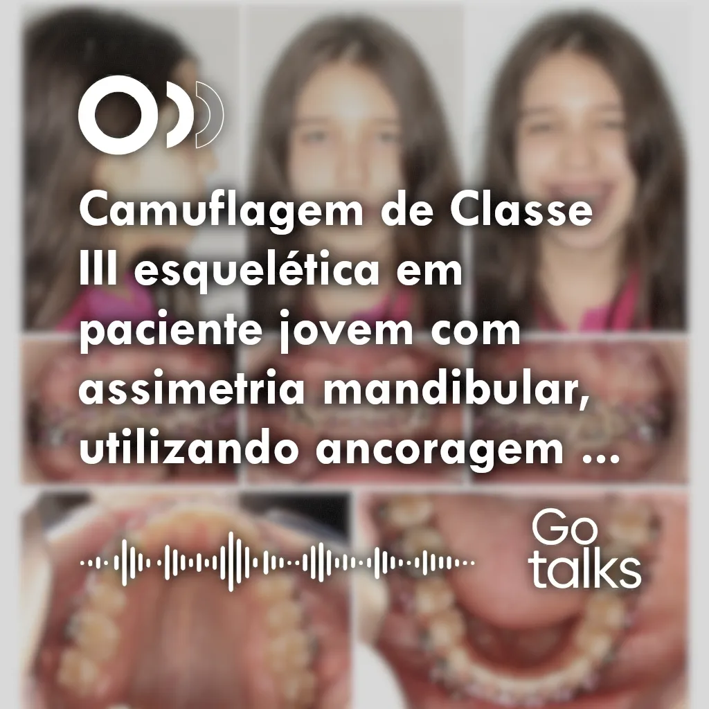 Camuflagem de Classe III esquelética em paciente jovem com assimetria mandibular, utilizando ancoragem esquelética