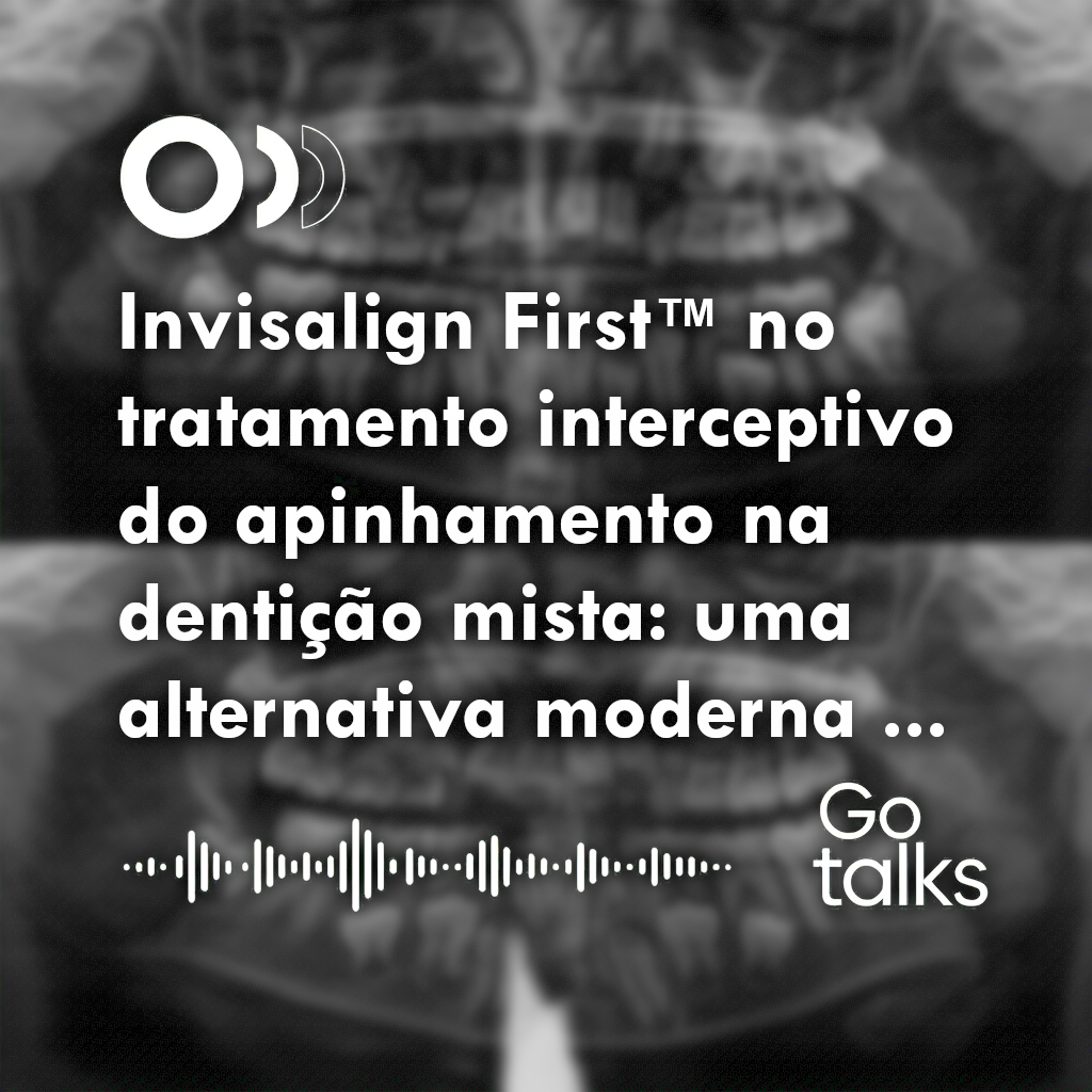 Invisalign First™ no tratamento interceptivo do apinhamento na dentição mista: uma alternativa moderna aos expansores convencionais