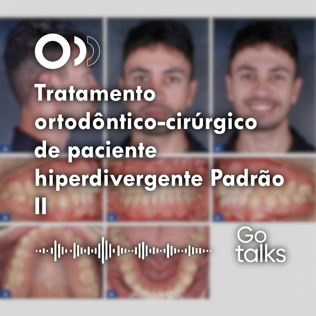 Tratamento ortodôntico-cirúrgico de paciente hiperdivergente Padrão II